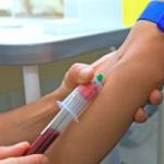 Blood test SRP - interpretation and norm